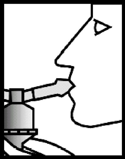image of Figure 3 Placing in Mouth - Figure 3 Placing in Mouth